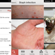 Image for article titled This Instagram for Doctors Lets You See Medicine's Most Bizarre Cases
